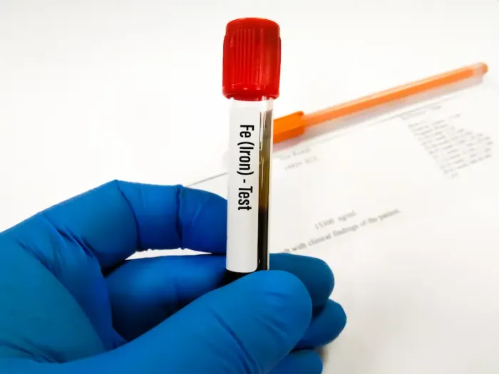Understanding Iron Blood Tests